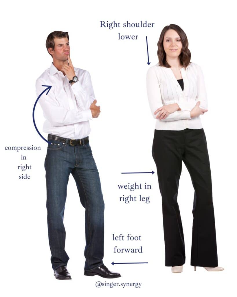 Image showing common postural patterns in standing posture